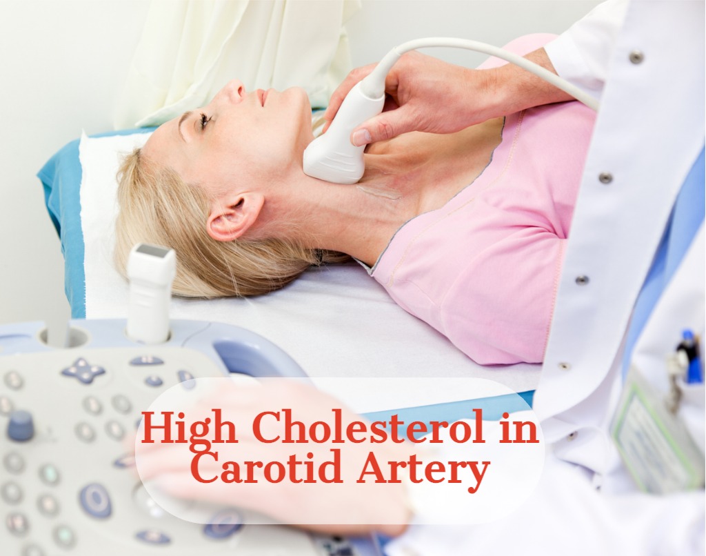 Carotid Doppler: Prevention today, peace of mind tomorrow Protect your heart and brain