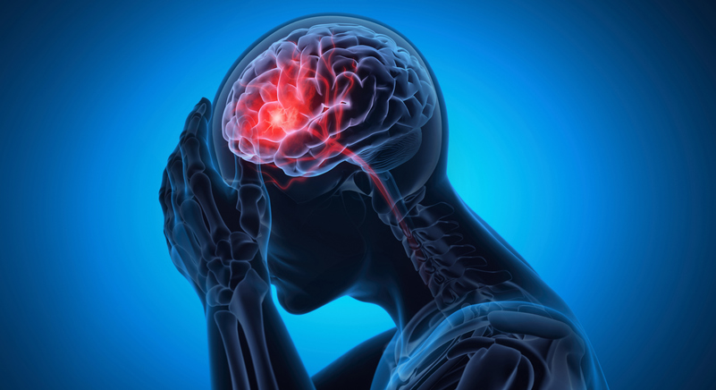 Migranes Neurologist evaluating a patient with migraine headaches at 14 Street Medical Arts in New York City