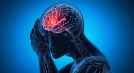 Migranes Neurologist evaluating a patient with migraine headaches at 14 Street Medical Arts in New York City