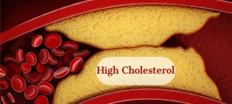 High Cholesterol? Know Your Arteries