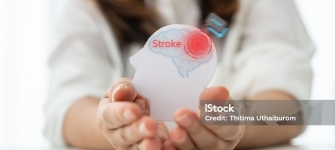 Headache and Stroke Neurologist explaining stroke warning signs and headache evaluation with Brain MRI and carotid ultrasound at 14 Street Medical Arts